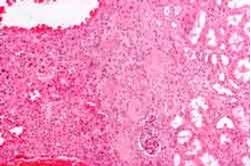 Kisah Nyata Wanita Cantik dan Lelaki Buruk Rupa